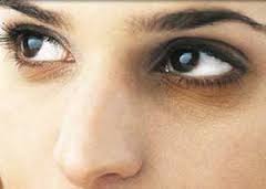 درمان سیاهی دور چشم