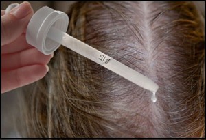 روش های درمان ریزش موی بانوان