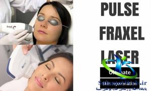 کاربرد های لیزر فراکسل