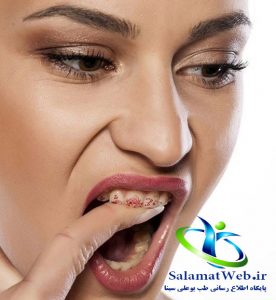 علل موثر در خشکی دهان