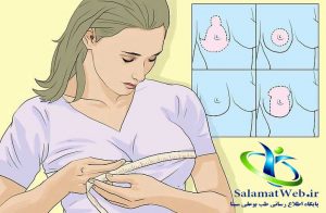 روش های جراحی کوچک کردن سینه