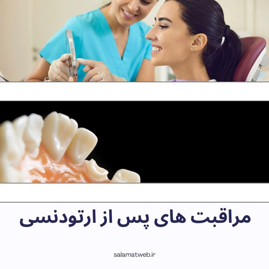 مراقبت های پس از ارتودنسی Post orthodontic care