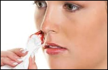 علت خونریزی از بینی و راه درمان آن
