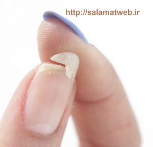 روش های خانگی جلوگیری از شکستن ناخن ها