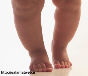 پا پرانتزی چیست؟
