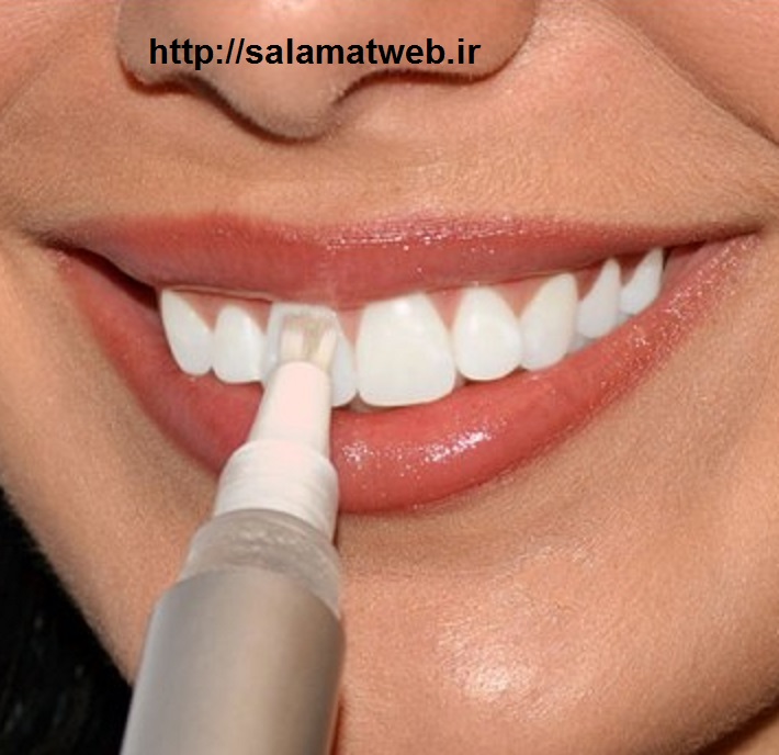 ژل سفید کننده دندان