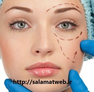 بلفاروپلاستی چیست؟
