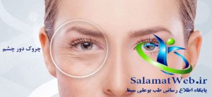چین و چروک زیر چشم چیست؟