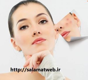 ساب سیژن چیست؟
