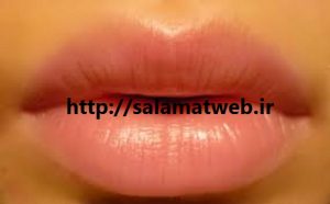 مراقبت های پس از جراحی زیبایی لب
