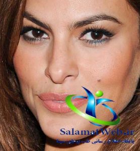 برداشتن خال با جراحی