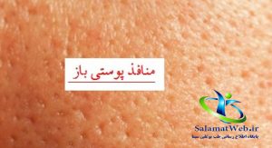 منافذ باز پوست چیست؟