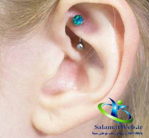 عوارض کاشت نگین های زیبایی