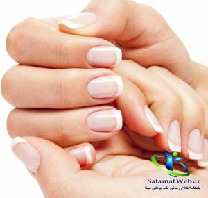 لکه های سفید بر روی ناخن