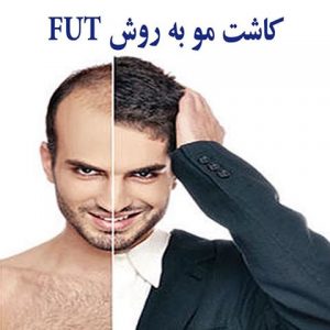 (FUT) چیست؟