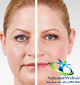 اسیدهیالورونیک چیست؟