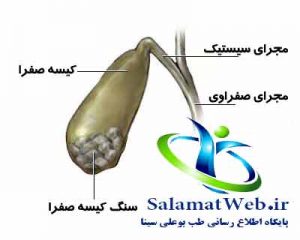 کیسه صفرا چیست؟