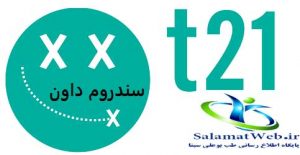 سندروم داون چیست؟