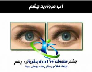 علت ابتلا به آب مروارید