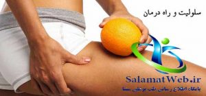 روش های مختلف درمان سلولیت
