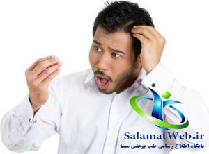علل ریزش مو