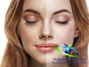 سفید کردن پوست صورت و بدن با ماسک های خانگی
