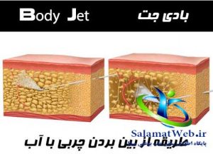بادی جت چیست