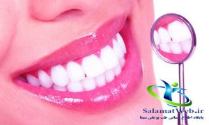 لمینیت دندان