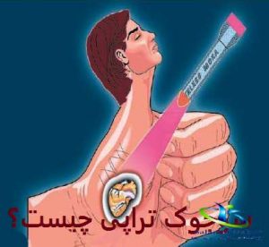 سوجوک تراپی