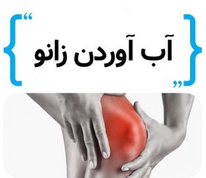 درمان آب آوردن زانو با ورزش