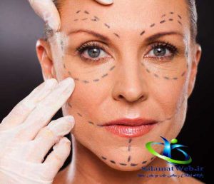 تزریق ژل یا چربی برای گونه
