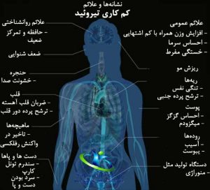 آزمایش کم کاری تیروئید