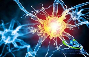 بیماری مولتیپل اسکلروزیس