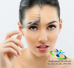 چروک های پیشانی
