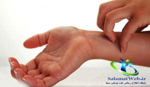 عکس حساسیت پوستی