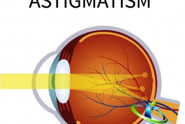 آستیگماتیسم چیست؟+روش های تشخیص و درمان آستیگماتیسم