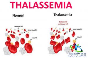 تشخیص تالاسمی