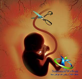 سقط جنین در اسلام