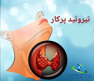 تیروئید پرکار