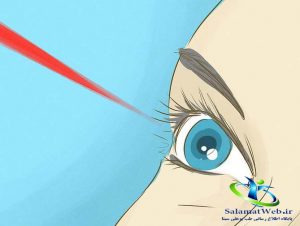 جراحی لیزیک چشم