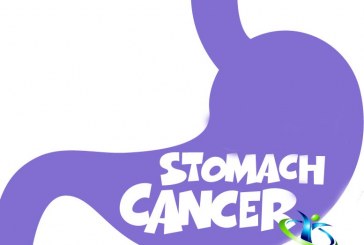 علایم سرطان معده +نحوه تشخیص و درمان سرطان معده