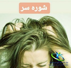 شوره سر چیست؟