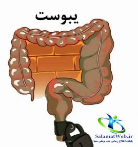 یبوست چیست؟