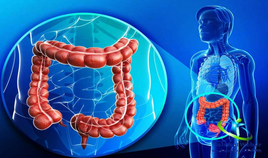 بیماری کولیت روده