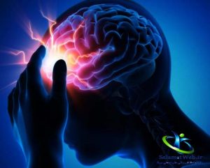 سکته مغزی
