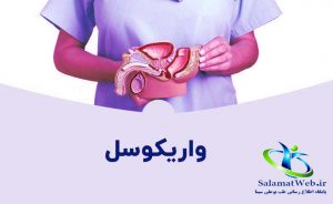 درمان بیماری واریکوسل